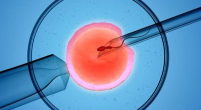 Infertility | Mannat IVF Centre | Mannat Super Speciliatity Hospital